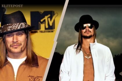 Kid Rock Real Name