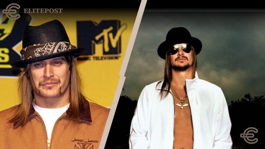 Kid Rock Real Name
